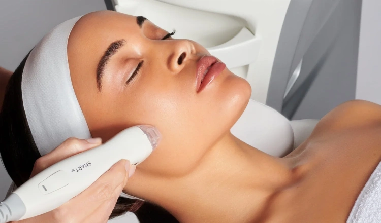 RF Microneedling