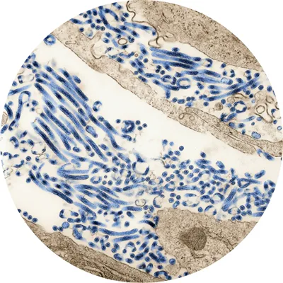 ASCE+ Exosomes Dubai 13 coenzyme cells